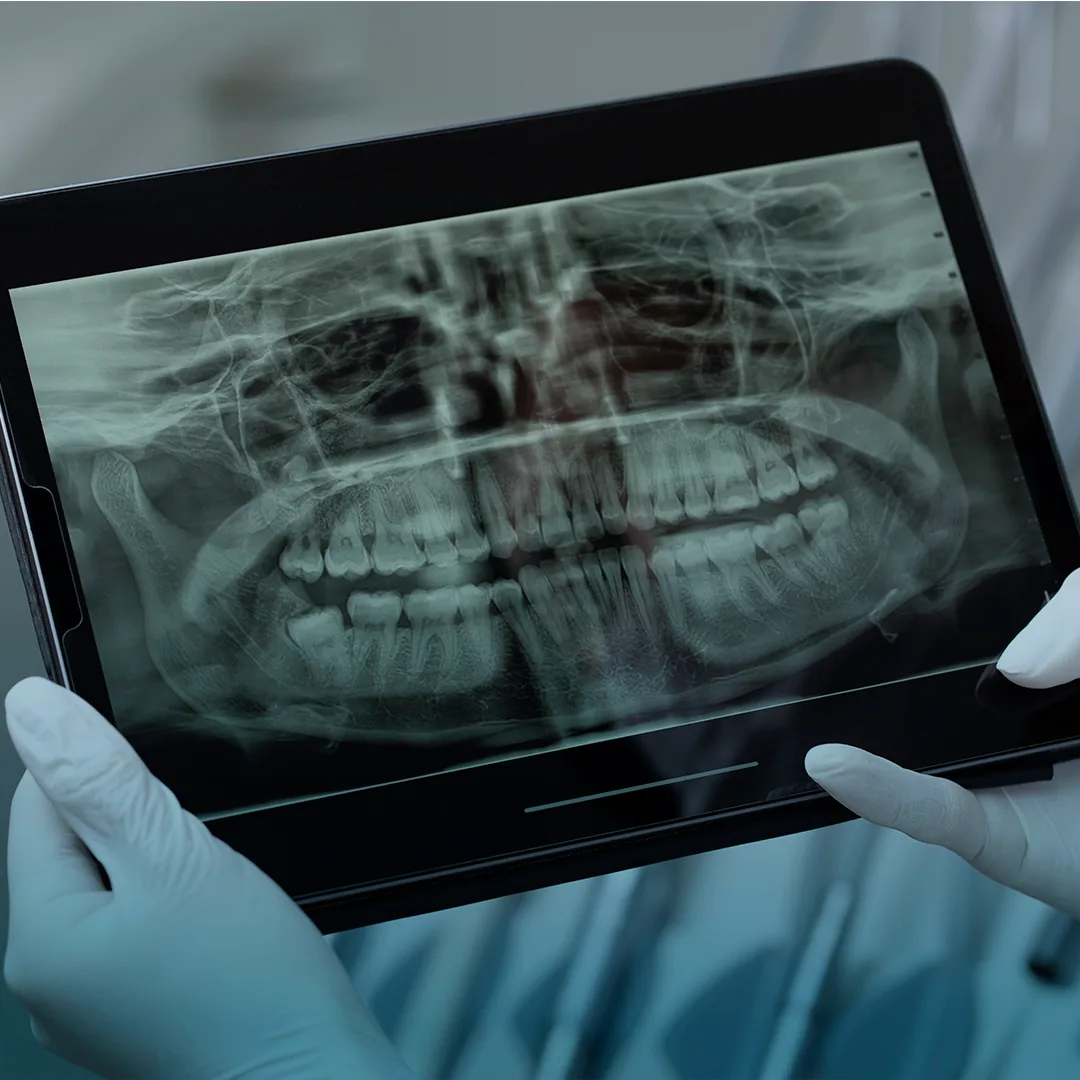Digital X-rays at Smile Design Team