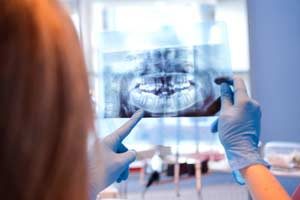 Dentist Digital X-Rays